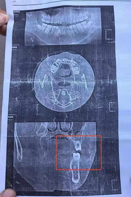 初三家长:校园突发暴力事件后的紧急应急处置方案 教育招生 初三家长:校园突发暴力事件后的紧急应急处置方案 教育招生
